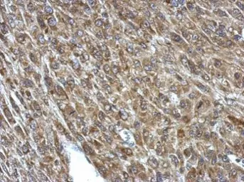 Anti-PCCA antibody used in IHC (Paraffin sections) (IHC-P). GTX114618