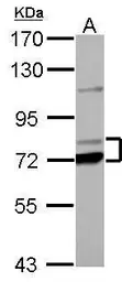 Anti-PCCA antibody used in Western Blot (WB). GTX114618