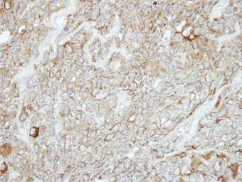 Anti-PCDH1 antibody [C2C3], C-term used in IHC (Paraffin sections) (IHC-P). GTX114620