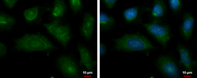 Anti-Autotaxin antibody used in Immunocytochemistry/ Immunofluorescence (ICC/IF). GTX114627