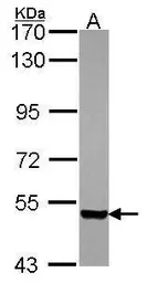 Anti-PDZK1 antibody [C1C3] used in Western Blot (WB). GTX114628