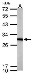 Anti-PGAM1 antibody [N1C3] used in Western Blot (WB). GTX114633