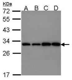 Anti-PGAM1 antibody [N1C3] used in Western Blot (WB). GTX114633
