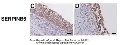 Anti-SERPINB6 antibody [N2C2], Internal used in IHC (Paraffin sections) (IHC-P). GTX114637