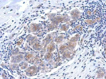 Anti-SERPINB6 antibody [N2C2], Internal used in IHC (Paraffin sections) (IHC-P). GTX114637