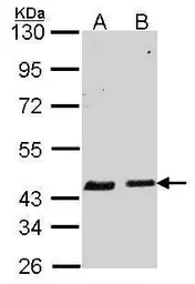 Anti-SERPINB6 antibody [N2C2], Internal used in Western Blot (WB). GTX114637