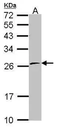 Anti-POLR2E antibody used in Western Blot (WB). GTX114648