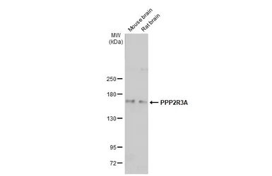 Anti-PPP2R3A antibody [C2C3], C-term used in Western Blot (WB). GTX114655