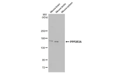 Anti-PPP2R3A antibody [C2C3], C-term used in Western Blot (WB). GTX114655
