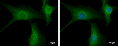 Anti-PPP2R3A antibody [C2C3], C-term used in Immunocytochemistry/ Immunofluorescence (ICC/IF). GTX114655