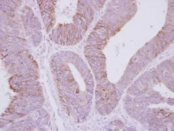 Anti-PPP2R3A antibody [C2C3], C-term used in IHC (Paraffin sections) (IHC-P). GTX114655