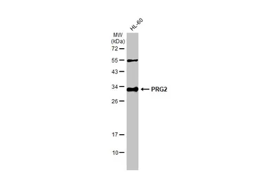 Anti-PRG2 antibody used in Western Blot (WB). GTX114664