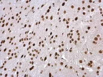 Anti-PSMC5 antibody used in IHC (Paraffin sections) (IHC-P). GTX114676