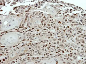 Anti-PSMC5 antibody used in IHC (Paraffin sections) (IHC-P). GTX114676