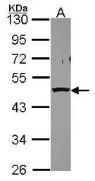 Anti-PSMC5 antibody used in Western Blot (WB). GTX114676