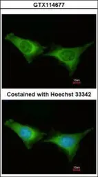 Anti-PSMC6 antibody used in Immunocytochemistry/ Immunofluorescence (ICC/IF). GTX114677