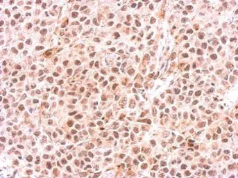 Anti-PSMC6 antibody used in IHC (Paraffin sections) (IHC-P). GTX114677