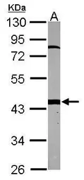 Anti-PSMC6 antibody used in Western Blot (WB). GTX114677
