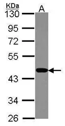 Anti-PSMC6 antibody used in Western Blot (WB). GTX114677
