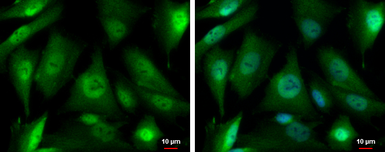 Anti-PSMD4 antibody [N1C2] used in Immunocytochemistry/ Immunofluorescence (ICC/IF). GTX114678