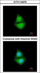 Anti-PSMD4 antibody [N2C3] used in Immunocytochemistry/ Immunofluorescence (ICC/IF). GTX114679