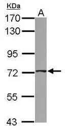 Anti-ABCD4 antibody [N1C1] used in Western Blot (WB). GTX114689