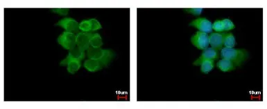 Anti-ABCD4 antibody used in Immunocytochemistry/ Immunofluorescence (ICC/IF). GTX114690