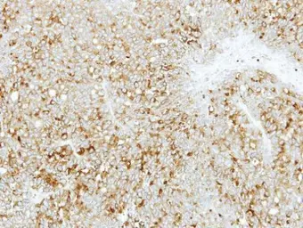 Anti-ABCD4 antibody used in IHC (Paraffin sections) (IHC-P). GTX114690