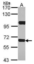 Anti-ABCD4 antibody used in Western Blot (WB). GTX114690