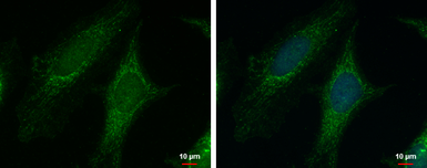 Anti-PYCR1 antibody used in Immunocytochemistry/ Immunofluorescence (ICC/IF). GTX114693