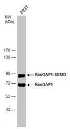 Anti-RanGAP1 antibody [N1N3] used in Western Blot (WB). GTX114700