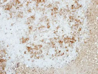 Anti-RAP2B antibody used in IHC (Paraffin sections) (IHC-P). GTX114702
