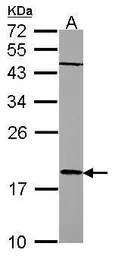 Anti-RARRES3 antibody [N1C3] used in Western Blot (WB). GTX114706