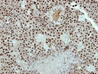 Anti-RbAp48 antibody [C1C3] used in IHC (Paraffin sections) (IHC-P). GTX114707