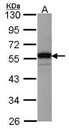 Anti-RbAp48 antibody [C1C3] used in Western Blot (WB). GTX114707