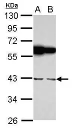 Anti-RBMS1 antibody [N2C3] used in Western Blot (WB). GTX114710