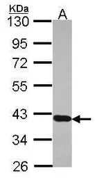Anti-RDH5 antibody [N2C3] used in Western Blot (WB). GTX114715