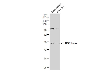 Anti-ROR beta antibody used in Western Blot (WB). GTX114722