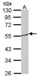 Anti-ROR beta antibody used in Western Blot (WB). GTX114722