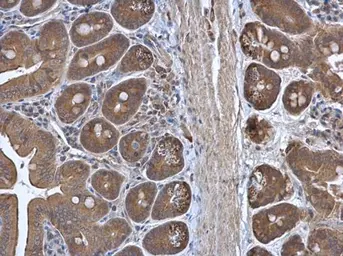 Anti-RPL3 antibody [N3C3] used in IHC (Paraffin sections) (IHC-P). GTX114725