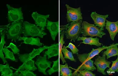 Anti-RPL24 antibody used in Immunocytochemistry/ Immunofluorescence (ICC/IF). GTX114729