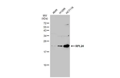 Anti-RPL24 antibody used in Western Blot (WB). GTX114729