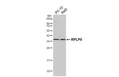 Anti-RPLP0 antibody used in Western Blot (WB). GTX114730