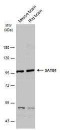 Anti-SATB1 antibody used in Western Blot (WB). GTX114737
