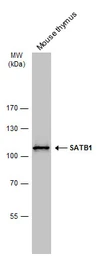 Anti-SATB1 antibody used in Western Blot (WB). GTX114737