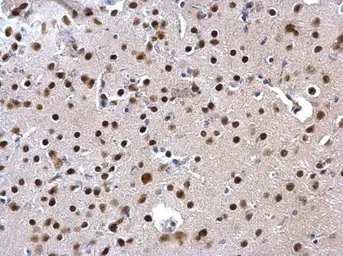 Anti-SATB1 antibody used in IHC (Paraffin sections) (IHC-P). GTX114737
