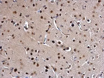 Anti-SATB1 antibody used in IHC (Paraffin sections) (IHC-P). GTX114737