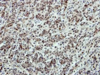 Anti-SATB1 antibody used in IHC (Paraffin sections) (IHC-P). GTX114737