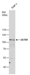 Anti-SATB1 antibody used in Western Blot (WB). GTX114737