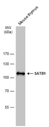 Anti-SATB1 antibody [C2C3], C-term used in Western Blot (WB). GTX114738